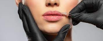 Studying the Rise in popularity of Russian Lip Fillers: An In-level Appear